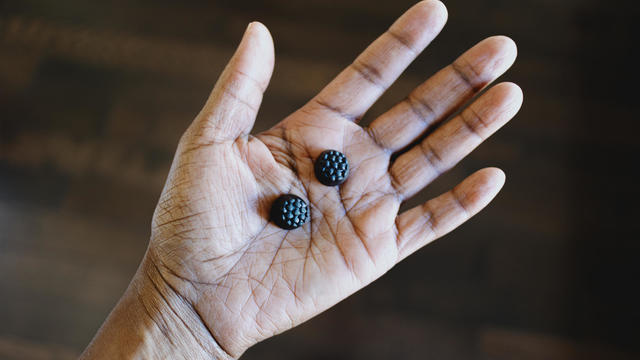 Woman Holds Gummy Nutritional Supplements in Palm of Her Hand 